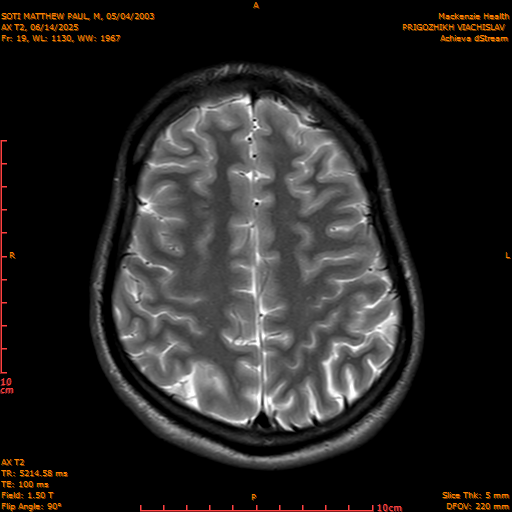 2025-06-14/AX T2/0020-IM855.png