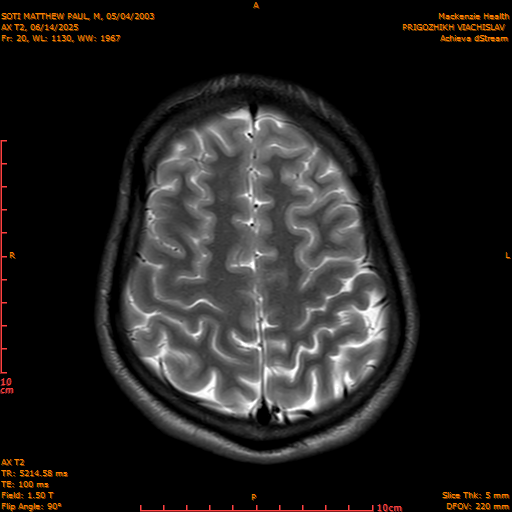2025-06-14/AX T2/0021-IM856.png