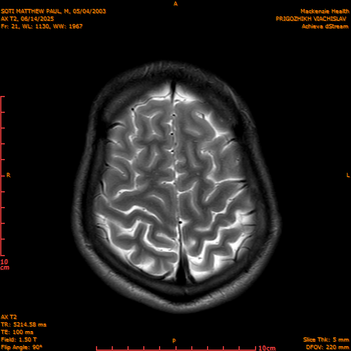 2025-06-14/AX T2/0022-IM857.png