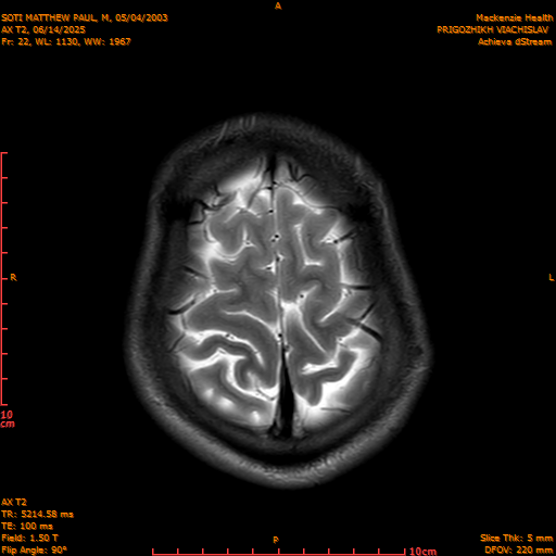 2025-06-14/AX T2/0023-IM858.png