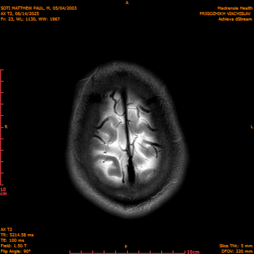 2025-06-14/AX T2/0024-IM859.png
