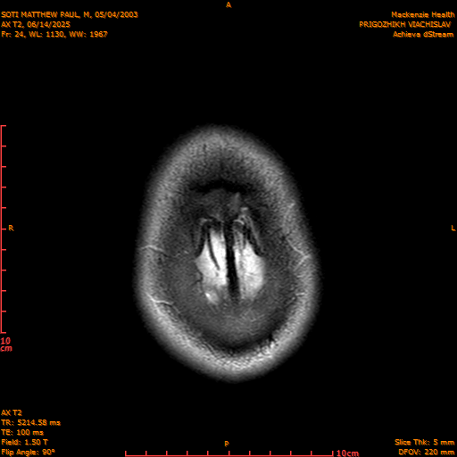2025-06-14/AX T2/0025-IM860.png