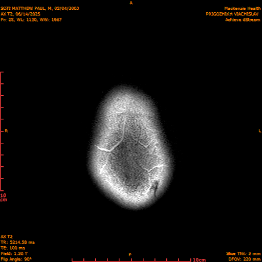2025-06-14/AX T2/0026-IM861.png
