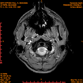 2025-06-14/AX T2FFE/0002-IM889.png