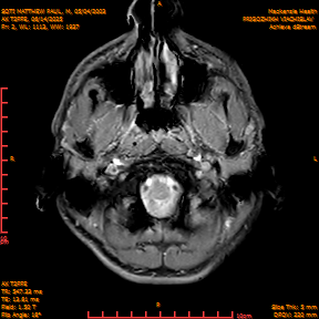 2025-06-14/AX T2FFE/0003-IM890.png