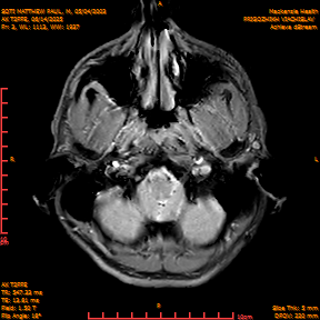 2025-06-14/AX T2FFE/0004-IM891.png