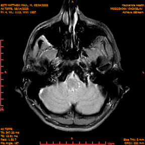 2025-06-14/AX T2FFE/0005-IM892.png