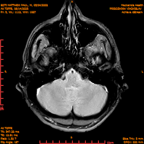 2025-06-14/AX T2FFE/0006-IM893.png