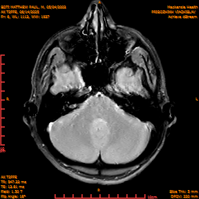 2025-06-14/AX T2FFE/0007-IM894.png