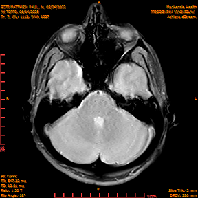 2025-06-14/AX T2FFE/0008-IM895.png