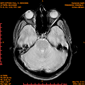 2025-06-14/AX T2FFE/0009-IM896.png