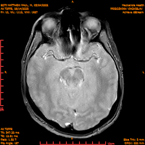 2025-06-14/AX T2FFE/0011-IM899.png