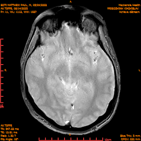 2025-06-14/AX T2FFE/0012-IM898.png