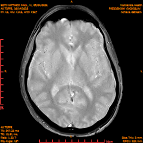 2025-06-14/AX T2FFE/0014-IM901.png