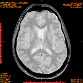 2025-06-14/AX T2FFE/0015-IM902.png