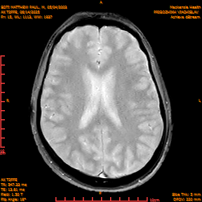 2025-06-14/AX T2FFE/0016-IM903.png