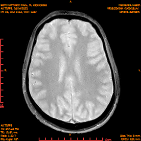 2025-06-14/AX T2FFE/0017-IM904.png