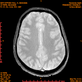 2025-06-14/AX T2FFE/0018-IM905.png