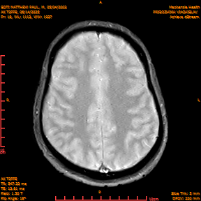 2025-06-14/AX T2FFE/0019-IM906.png