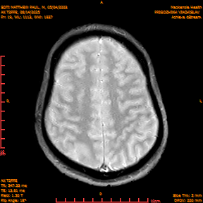 2025-06-14/AX T2FFE/0020-IM907.png