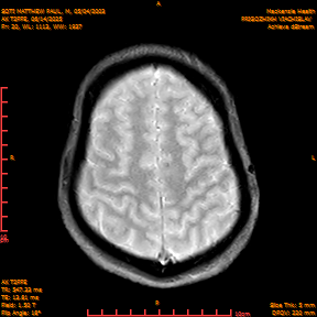 2025-06-14/AX T2FFE/0021-IM908.png