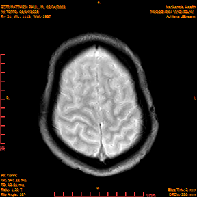 2025-06-14/AX T2FFE/0022-IM909.png