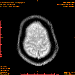 2025-06-14/AX T2FFE/0023-IM910.png