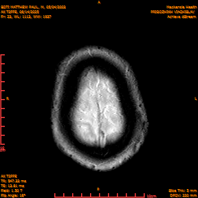 2025-06-14/AX T2FFE/0024-IM911.png
