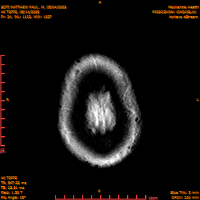 2025-06-14/AX T2FFE/0025-IM912.png