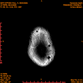 2025-06-14/AX T2FFE/0026-IM913.png