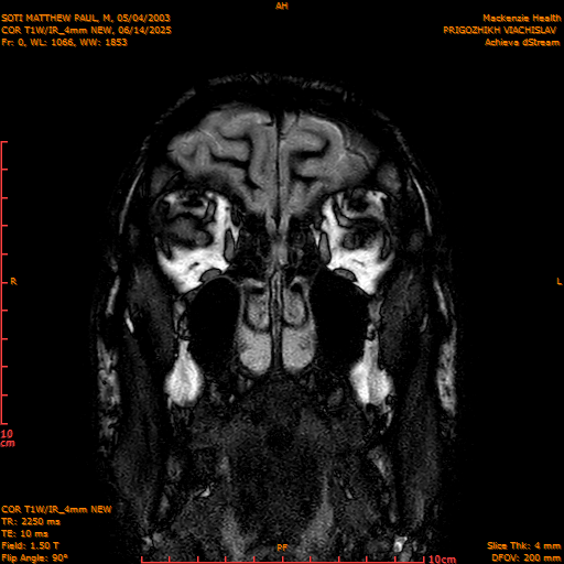 2025-06-14/COR T1W-IR_4mm NEW/0001-IM992.png