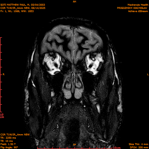 2025-06-14/COR T1W-IR_4mm NEW/0002-IM993.png