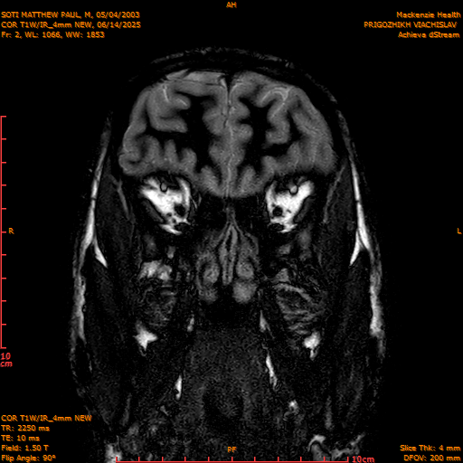 2025-06-14/COR T1W-IR_4mm NEW/0003-IM994.png