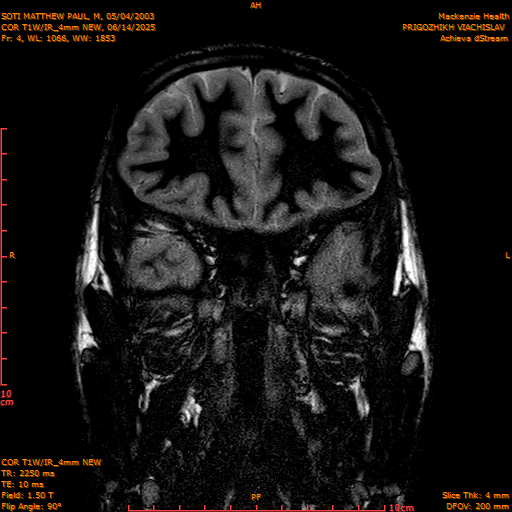 2025-06-14/COR T1W-IR_4mm NEW/0005-IM996.png