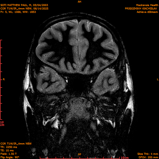 2025-06-14/COR T1W-IR_4mm NEW/0006-IM997.png