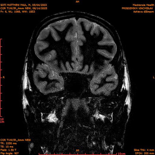 2025-06-14/COR T1W-IR_4mm NEW/0007-IM998.png
