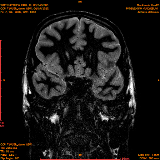 2025-06-14/COR T1W-IR_4mm NEW/0008-IM999.png