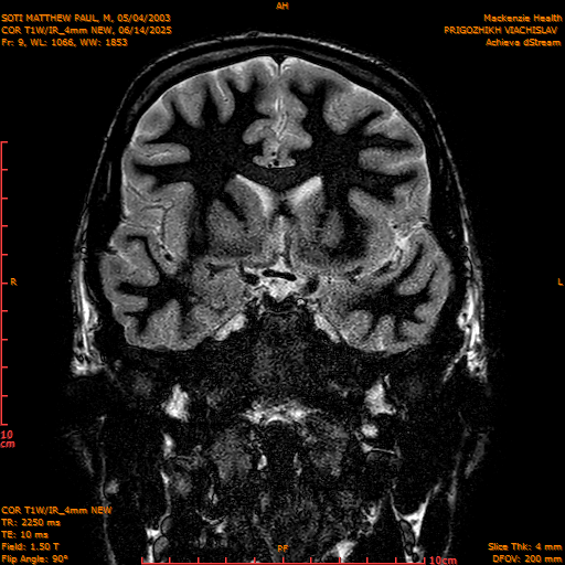 2025-06-14/COR T1W-IR_4mm NEW/0010-IM1001.png