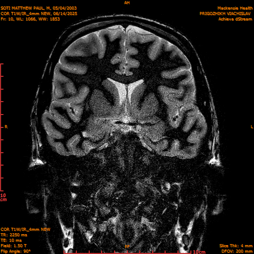 2025-06-14/COR T1W-IR_4mm NEW/0011-IM1002.png