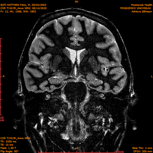 2025-06-14/COR T1W-IR_4mm NEW/0013-IM1004.png