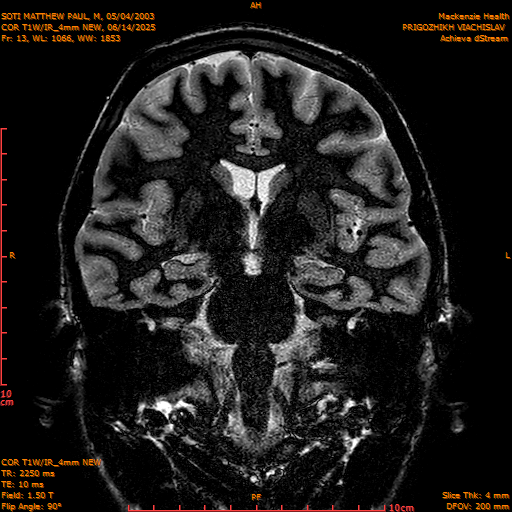 2025-06-14/COR T1W-IR_4mm NEW/0014-IM1005.png
