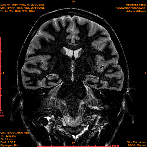 2025-06-14/COR T1W-IR_4mm NEW/0015-IM1006.png