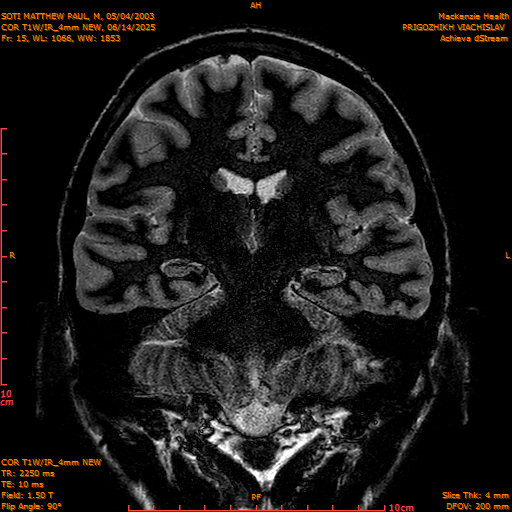 2025-06-14/COR T1W-IR_4mm NEW/0016-IM1007.png
