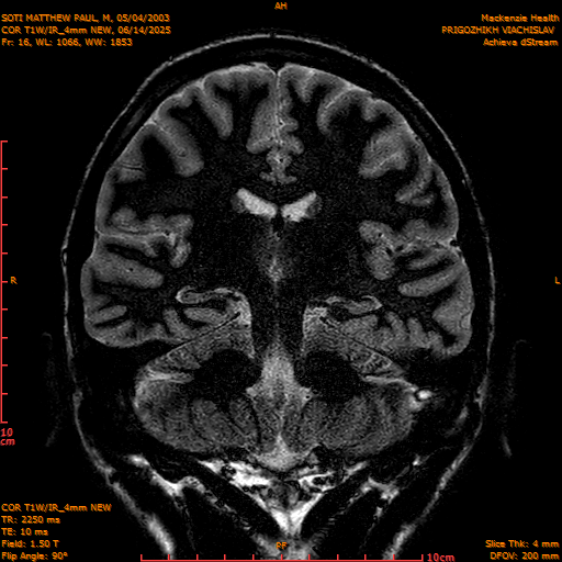 2025-06-14/COR T1W-IR_4mm NEW/0017-IM1008.png