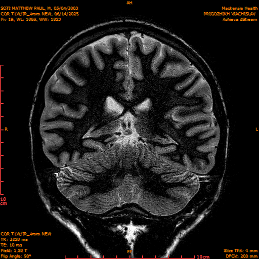 2025-06-14/COR T1W-IR_4mm NEW/0020-IM1011.png