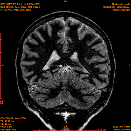 2025-06-14/COR T1W-IR_4mm NEW/0021-IM1012.png
