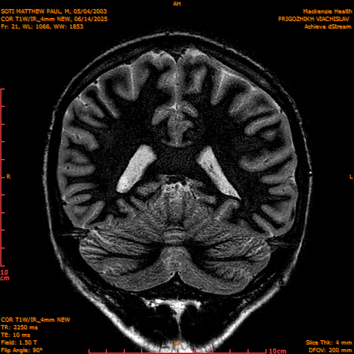 2025-06-14/COR T1W-IR_4mm NEW/0022-IM1013.png