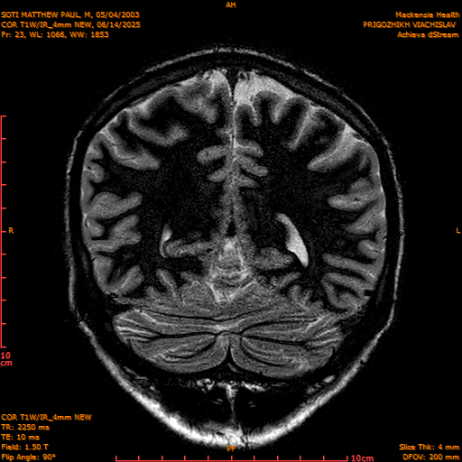 2025-06-14/COR T1W-IR_4mm NEW/0024-IM1015.png