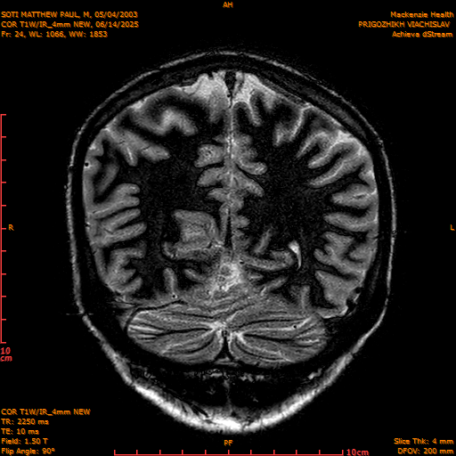 2025-06-14/COR T1W-IR_4mm NEW/0025-IM1016.png