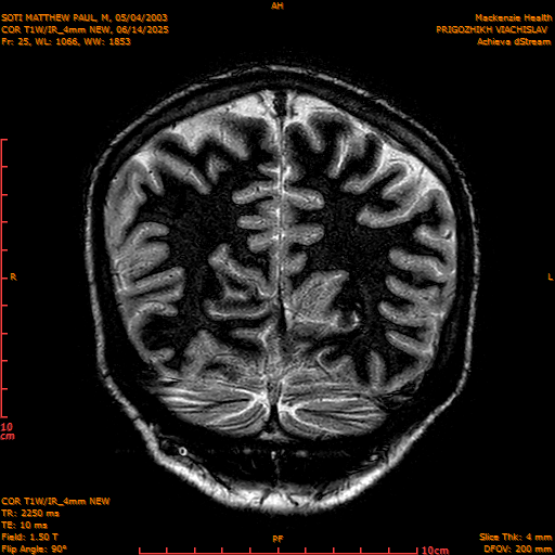 2025-06-14/COR T1W-IR_4mm NEW/0026-IM1017.png
